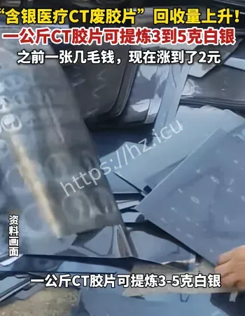 银价暴涨
